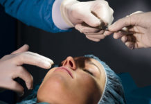 ¿Qué es una Rinoplastia o cirugía de nariz?